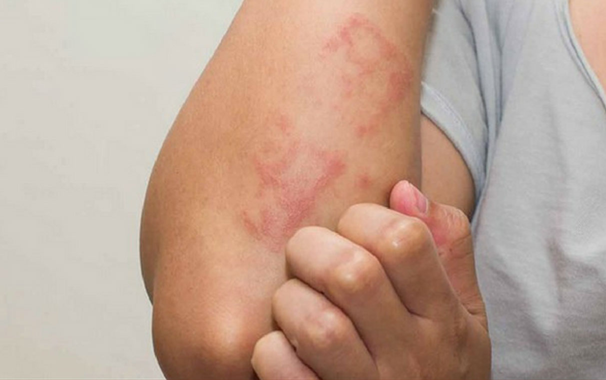 how_we_get_fungal-infection